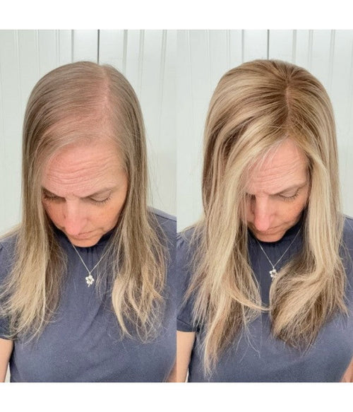 🌷 Final Hours! Stay Cool & Confident with Our 2026 Lightweight & Breathable Wavy Hair Topper