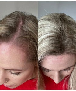 8.5” x 9” Breeze | Ultra-breathable Lace Top Hair Topper With Lace Front| Ponytail Topper|Low Density