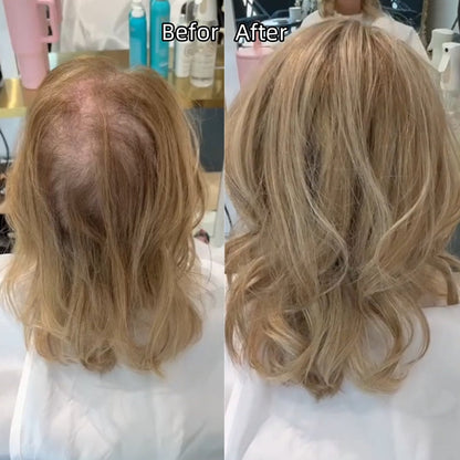 🌷 Final Hours! Stay Cool & Confident with Our 2026 Lightweight & Breathable Wavy Hair Topper